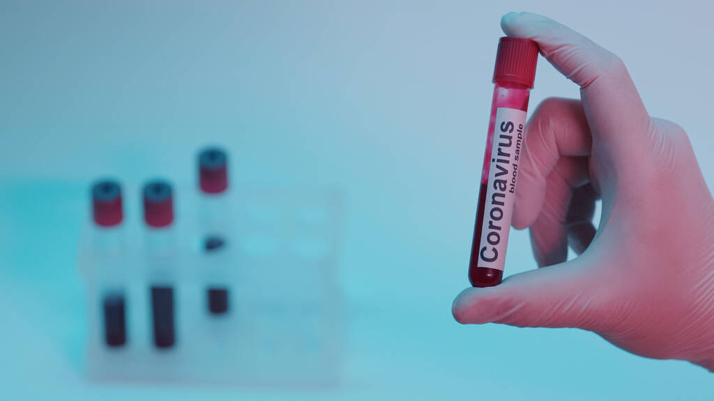 partial view of scientist in latex glove holding test tube with blood sample and coronavirus lettering on blue  - Fotoğraf, Görsel