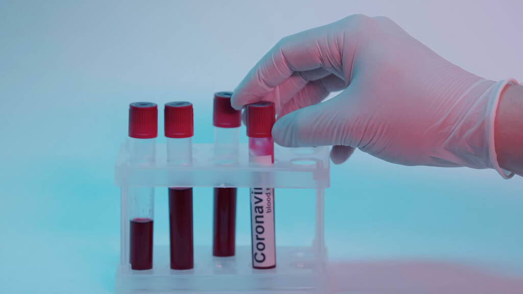 partial view of scientist in latex glove taking test tube with blood sample and coronavirus lettering on blue  - Zdjęcie, obraz