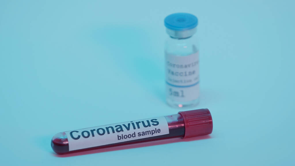 blood sample in test tube with lettering and blurred bottle with coronavirus vaccine on blue - Valokuva, kuva