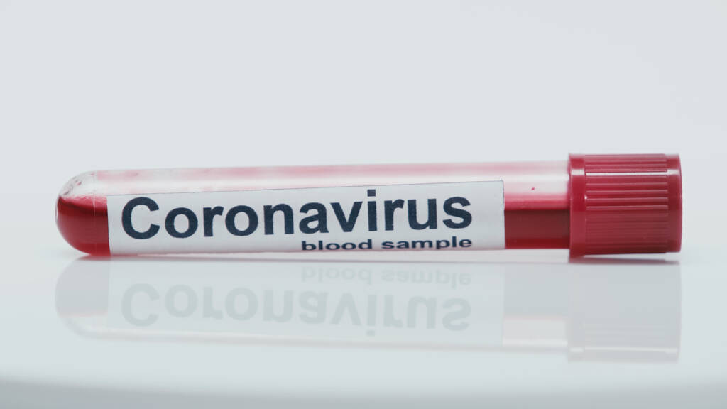 close up of test tube with coronavirus lettering and blood sample on white - 写真・画像