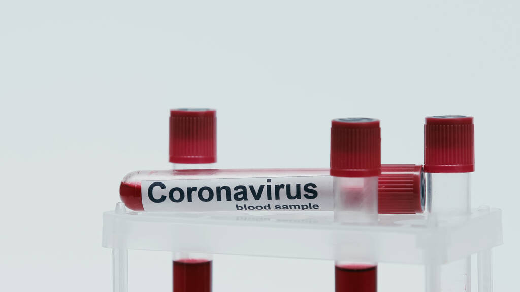 glass test tubes with coronavirus lettering and blood sample on white - Fotoğraf, Görsel