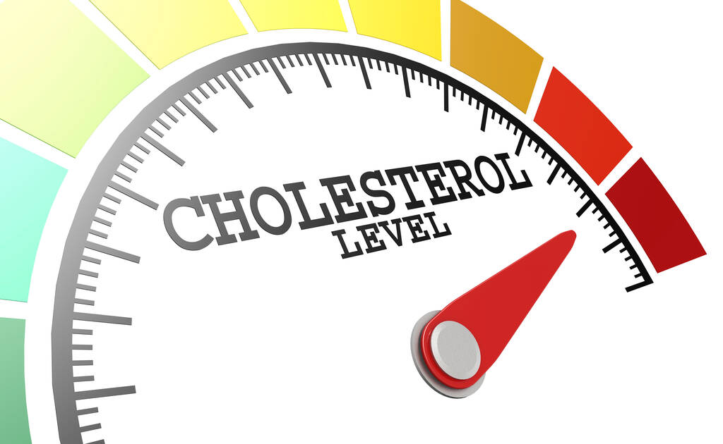 Cholesterol level measuring scale with color indicator, 3d rendering - Fotó, kép
