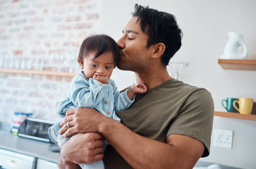 Síndrome de Down vínculo del bebé con el padre en su casa, beso y afecto por el cuidado de los padres para el bebé con necesidades especiales. Amor, familia y niños con padres asiáticos abrazando recién nacido con discapacidad. - Foto, Imagen