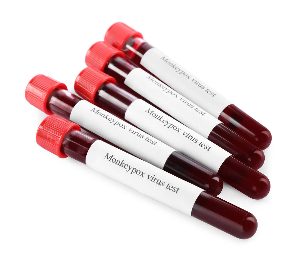 Δοκιμή ιού ευλογιάς μαϊμούς. Σωλήνες δειγματοληψίας με αίμα σε λευκό φόντο - Φωτογραφία, εικόνα