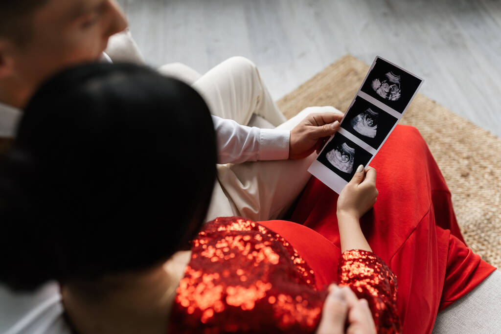 вид сверху на мужчину и женщину в элегантной одежде с ультразвуковым сканированием с подтверждением беременности  - Фото, изображение