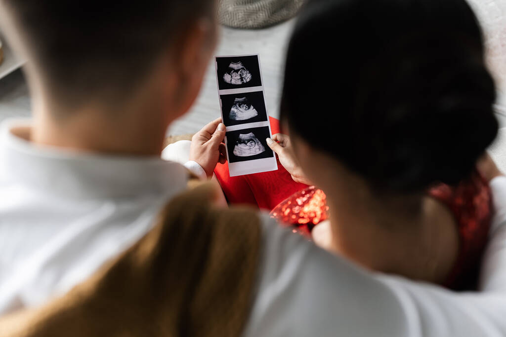 back view of blurred couple holding ultrasound scan with pregnancy confirmation - Photo, Image