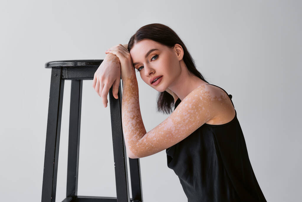 Pretty brunette woman with vitiligo posing near chair isolated on grey  - Photo, Image