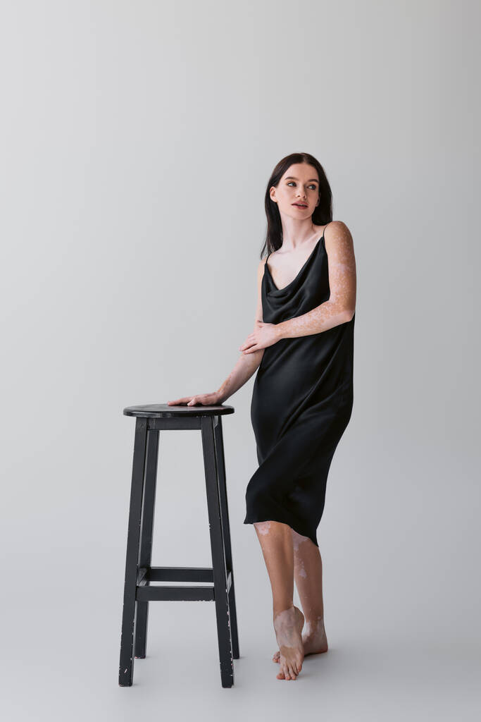 Full length of young woman with vitiligo looking away near chair on grey background  - Photo, Image