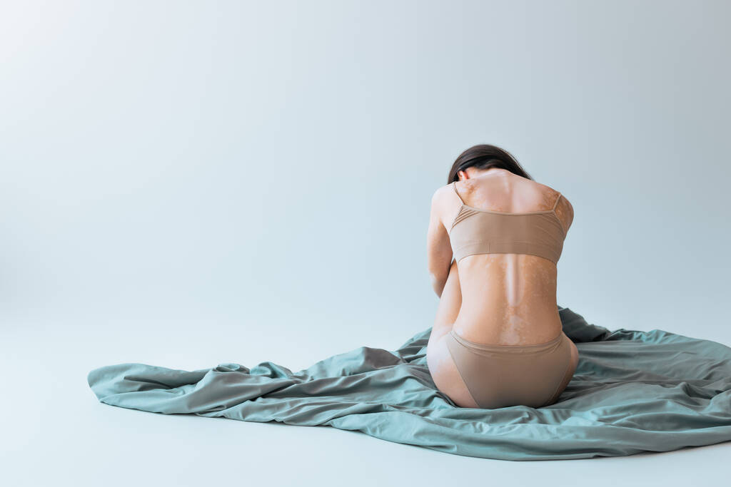 πίσω όψη της μελαχρινής γυναίκας με λεύκη χρονολογική κατάσταση του δέρματος κάθεται σε κουβέρτα σε γκρι φόντο  - Φωτογραφία, εικόνα