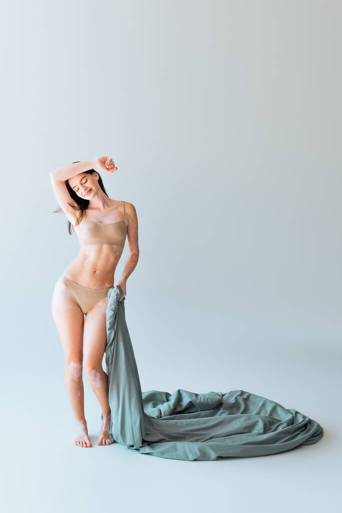 полная длина веселой женщины с витилиго состояние кожи проведение одеяло на серый  - Фото, изображение