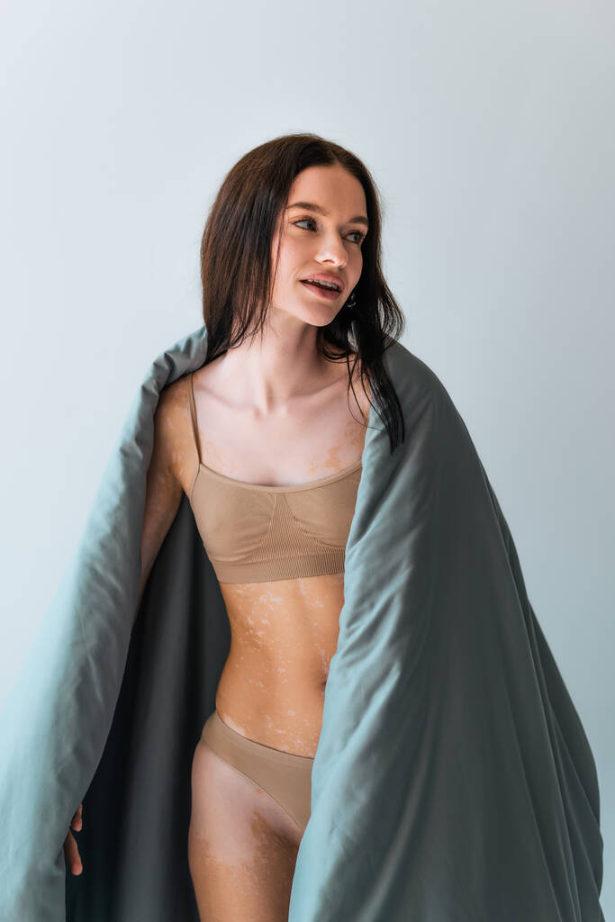 молодая женщина с заболеванием кожи витилиго стоял покрытый одеялом изолированы на сером  - Фото, изображение