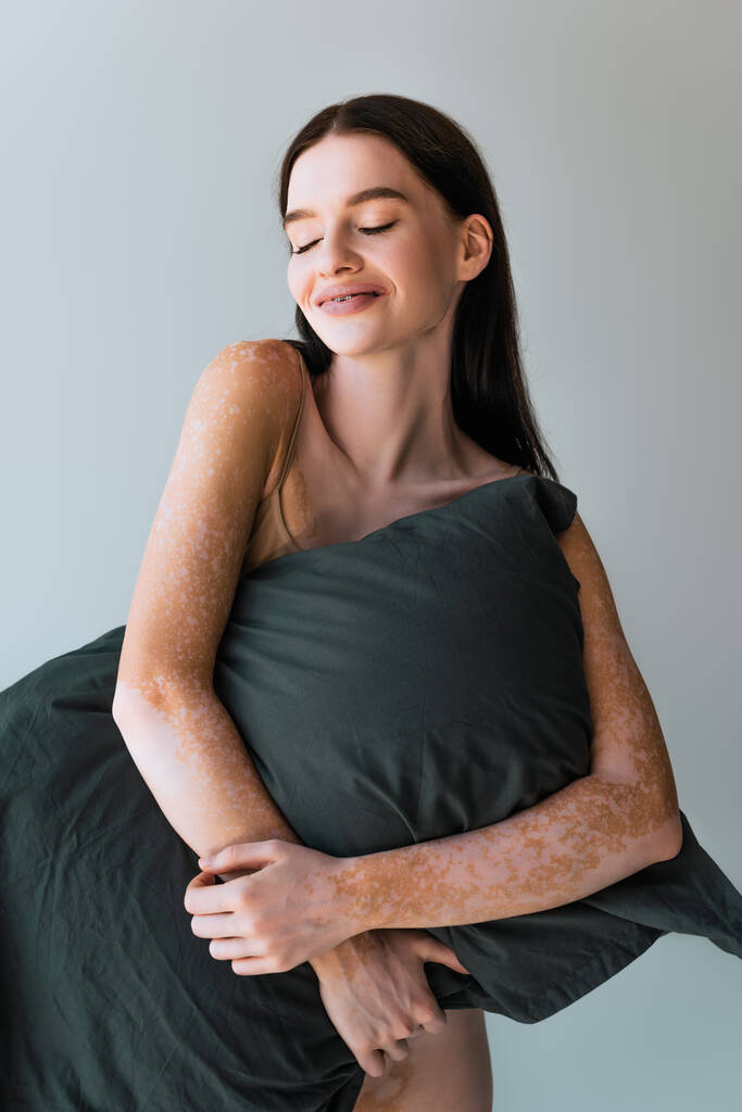 heureux jeune femme avec vitiligo tenant oreiller tout en souriant isolé sur gris - Photo, image