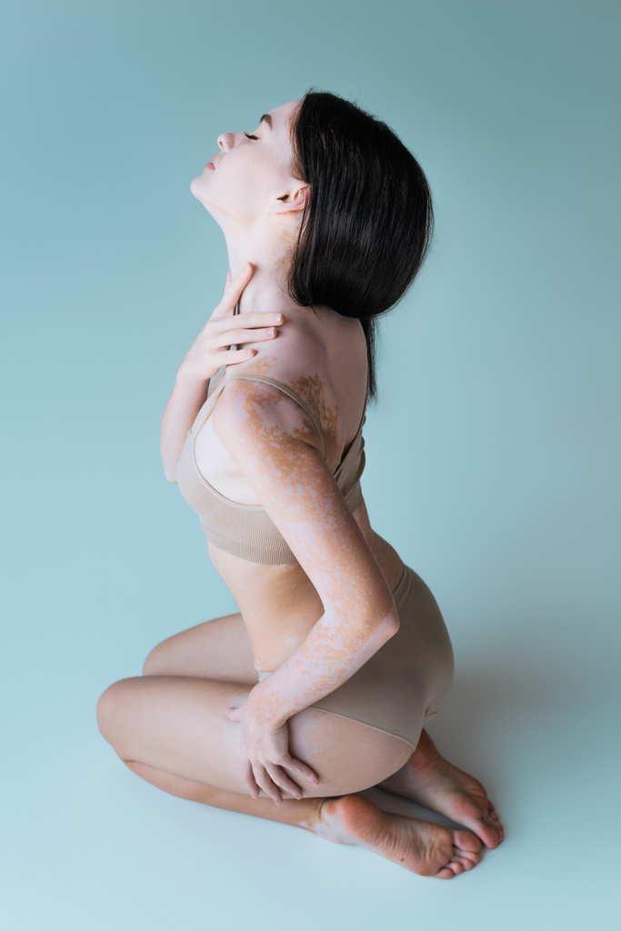 descalça e jovem com vitiligo e olhos fechados posando em lingerie bege no cinza - Fotografia, imagem