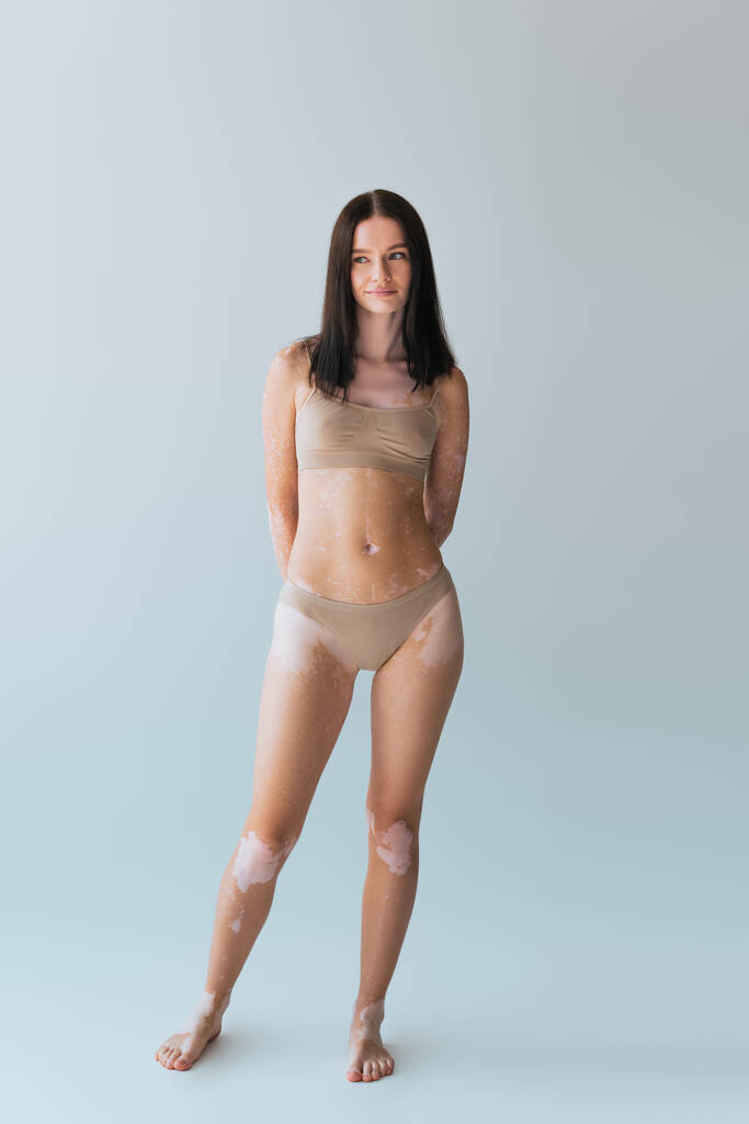 plná délka usmívající se mladá žena s vitiligo pózování v béžové spodní prádlo na šedé - Fotografie, Obrázek