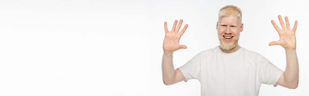 Χαρούμενος αλμπίνος άντρας με t-shirt να κουνάει χέρια απομονωμένα σε λευκό, λάβαρο - Φωτογραφία, εικόνα