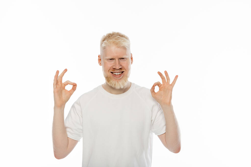 glücklicher Albino-Mann im T-Shirt zeigt ok Zeichen mit Händen isoliert auf weiß  - Foto, Bild