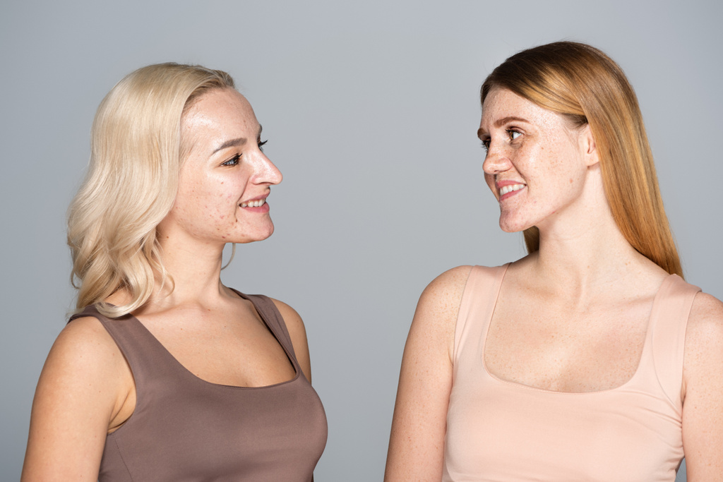 Blonde Frau mit Akne im Gesicht sieht sommersprossigen Freund isoliert auf grau  - Foto, Bild