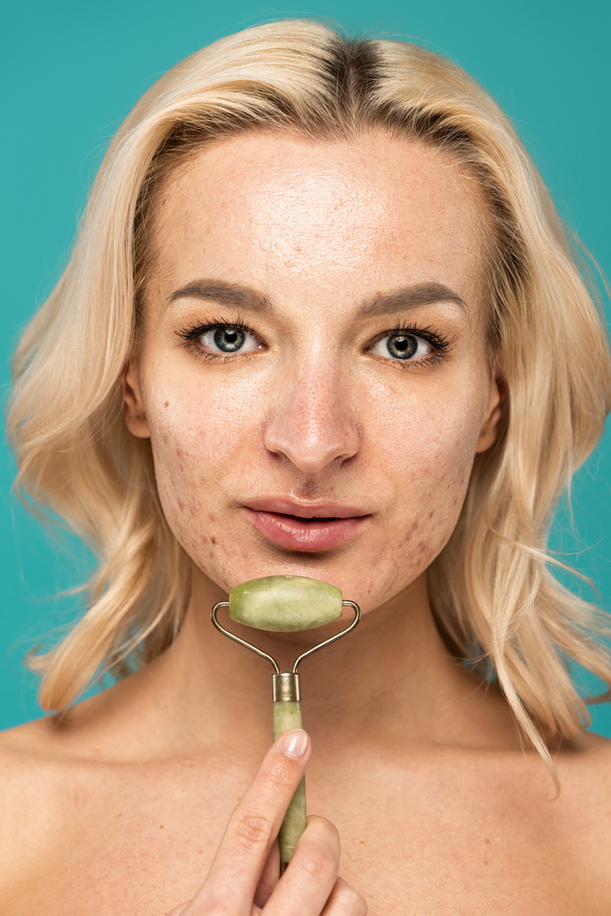close-up de mulher loira com acne segurando rolo de jade perto do rosto isolado em turquesa - Foto, Imagem