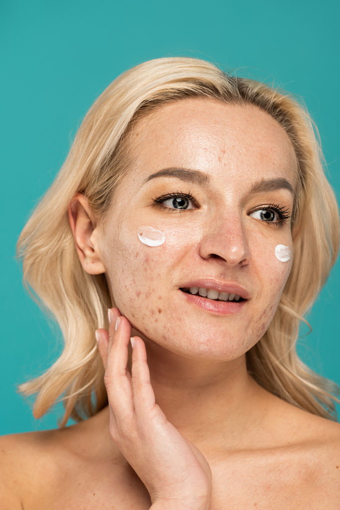 mulher loira com problemas de pele aplicando creme de tratamento no rosto isolado em turquesa  - Foto, Imagem