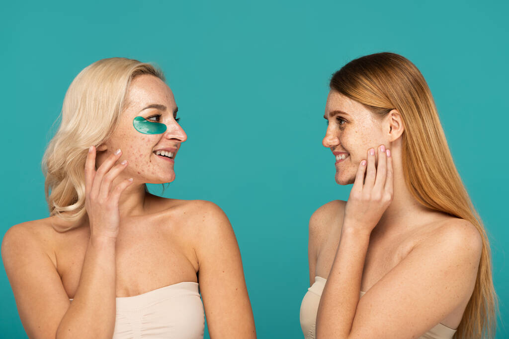 blonde woman with acne and eye patches smiling while looking at freckled friend isolated on turquoise  - Photo, Image
