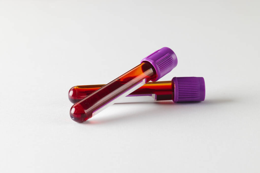 Két lila fedelű vérmintatartó cső fehér alapon. Véregészségügyi diagnosztika, elemzés és véradás. - Fotó, kép