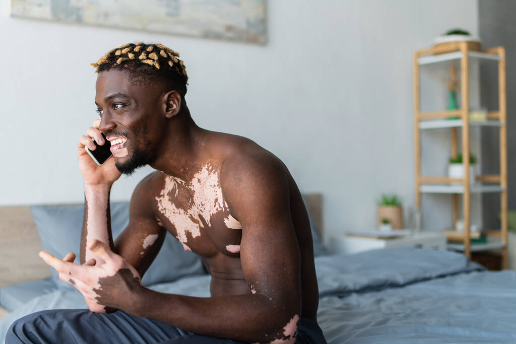 Fröhlich afrikanisch-amerikanischer Mann mit Vitiligo spricht auf Smartphone im Schlafzimmer  - Foto, Bild
