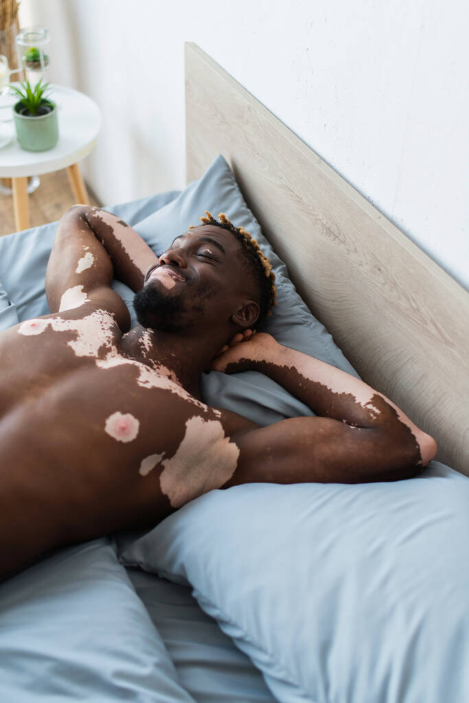 glimlachende Afrikaanse Amerikaanse man met vitiligo ontspannen op bed thuis  - Foto, afbeelding