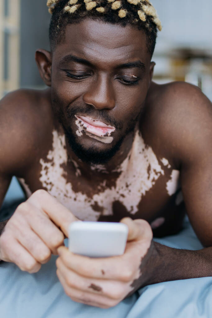Escéptico hombre afroamericano con vitiligo usando un teléfono inteligente borroso en la cama  - Foto, Imagen