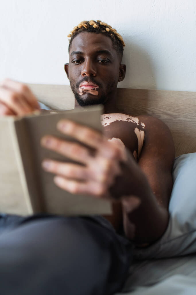 Hemdloser afrikanisch-amerikanischer Mann mit Vitiligo beim Lesen verschwommenes Buch auf dem Bett  - Foto, Bild