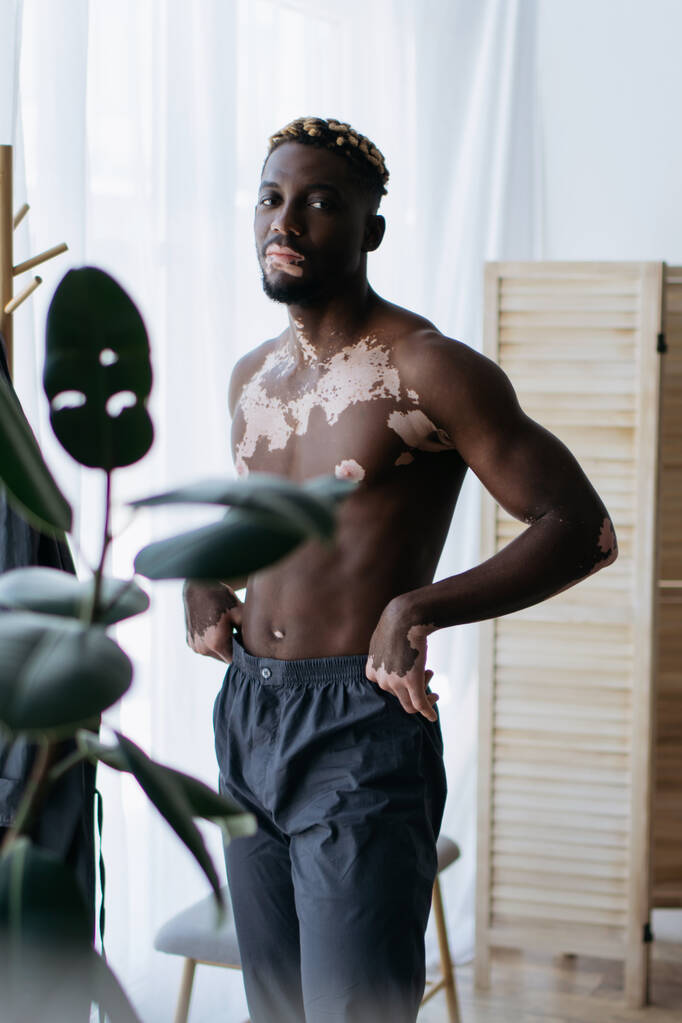 hombre afroamericano sin camisa con vitiligo de pie cerca de la planta en casa  - Foto, Imagen