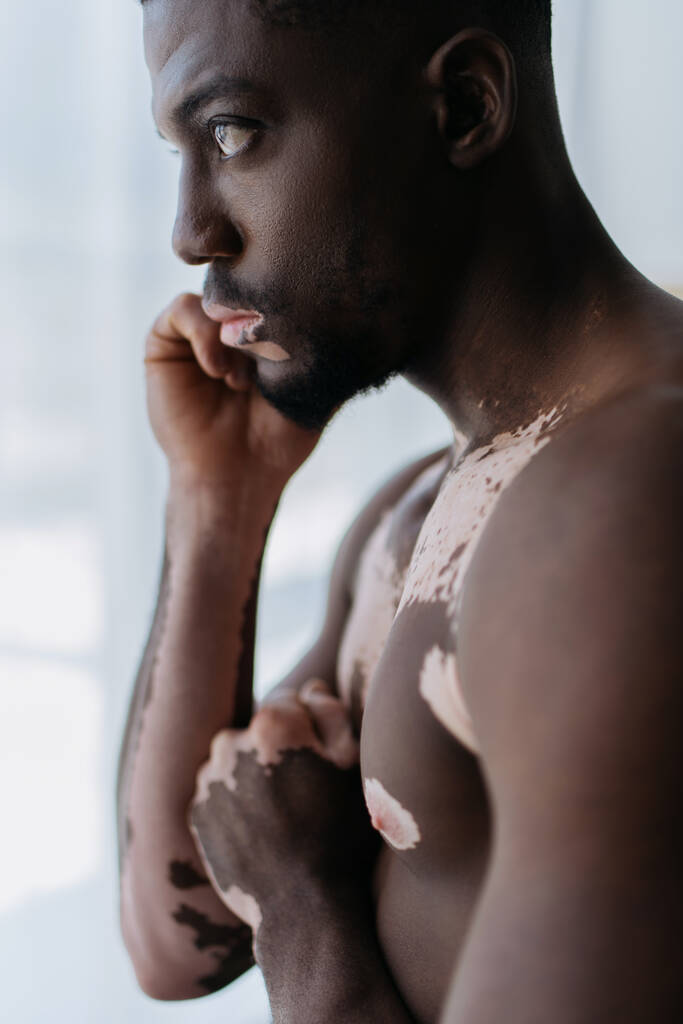 Vue latérale de l'homme afro-américain torse nu avec vitiligo debout à la maison  - Photo, image