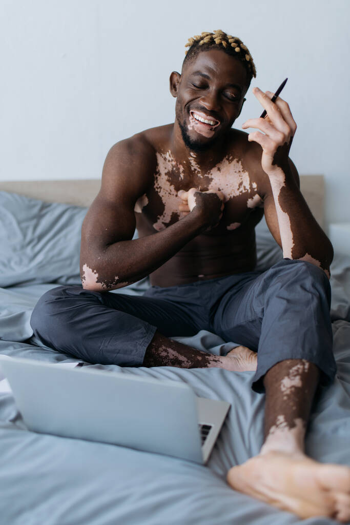 Θετικός και ημίγυμνος Αφροαμερικάνος με λεύκη να κρατάει στυλό κοντά στο λάπτοπ στο κρεβάτι.  - Φωτογραφία, εικόνα