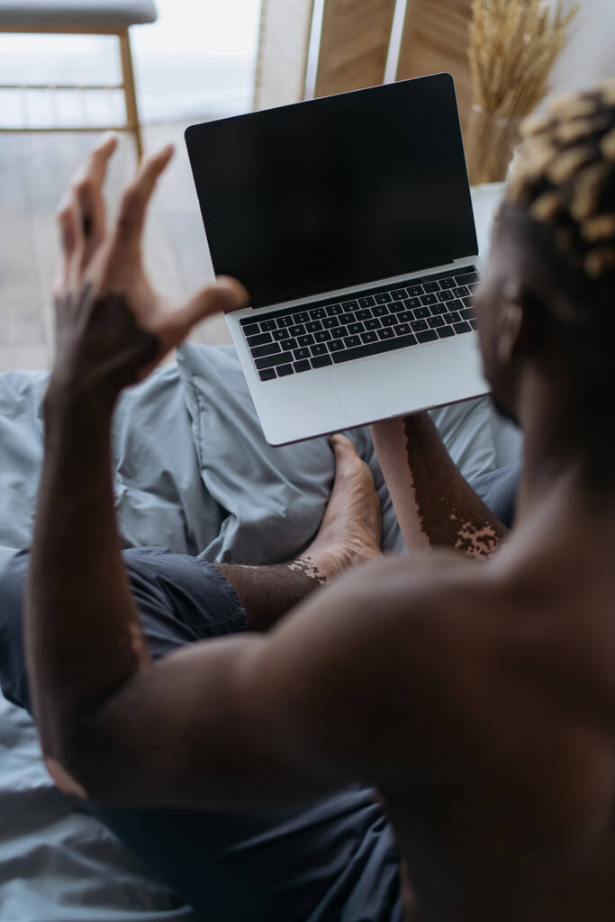 Высокоугольный вид размытого африканского мужчины с витилиго, имеющего видеозвонок на ноутбуке в спальне  - Фото, изображение