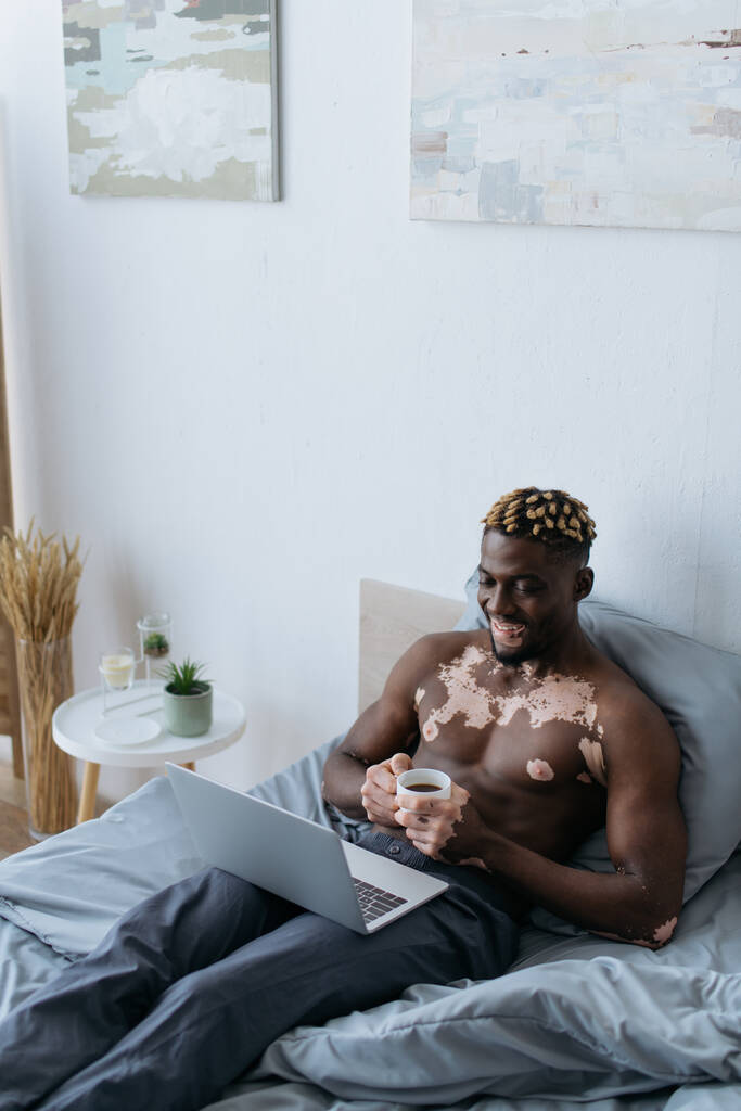 Улыбающийся африканский американец с витилиго держа чашку кофе и с помощью ноутбука на кровати  - Фото, изображение