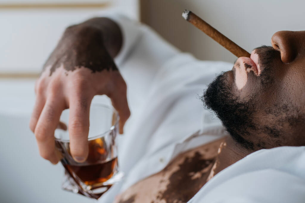 Gewassen uitzicht op de Afrikaanse Amerikaanse man met vitiligo in shirt roken sigaar en het houden van whisky in de badkamer  - Foto, afbeelding