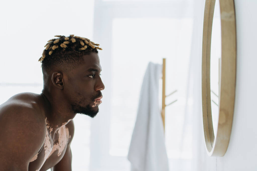 Африканский мужчина без рубашки с витилиго смотрит в зеркало в ванной комнате  - Фото, изображение