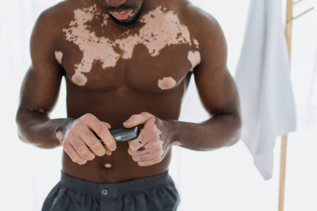 Ausgeschnittene Ansicht von hemdslosen afrikanisch-amerikanischen Mann mit Vitiligo hält Deo im Badezimmer  - Foto, Bild