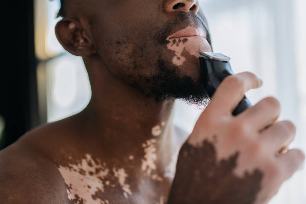 Ausgeschnittene Ansicht von afrikanisch-amerikanischen Mann mit Vitiligo-Rasur mit elektrischem Rasierer am Morgen  - Foto, Bild