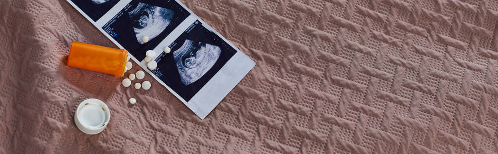 horní pohled na lahvičku s prášky, ultrazvuk, nenarozené dítě, antikoncepce, koncepce potratů, banner - Fotografie, Obrázek