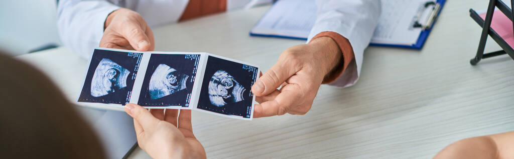 Arzt zeigt lgbt-Paar Ultraschall des Babys, Konzept der In-vitro-Fertilisation, Banner - Foto, Bild