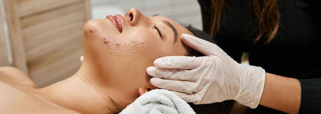 masaje facial para piel propensa al acné, masajista en guantes y cliente asiático con ojos cerrados, pancarta - Foto, imagen