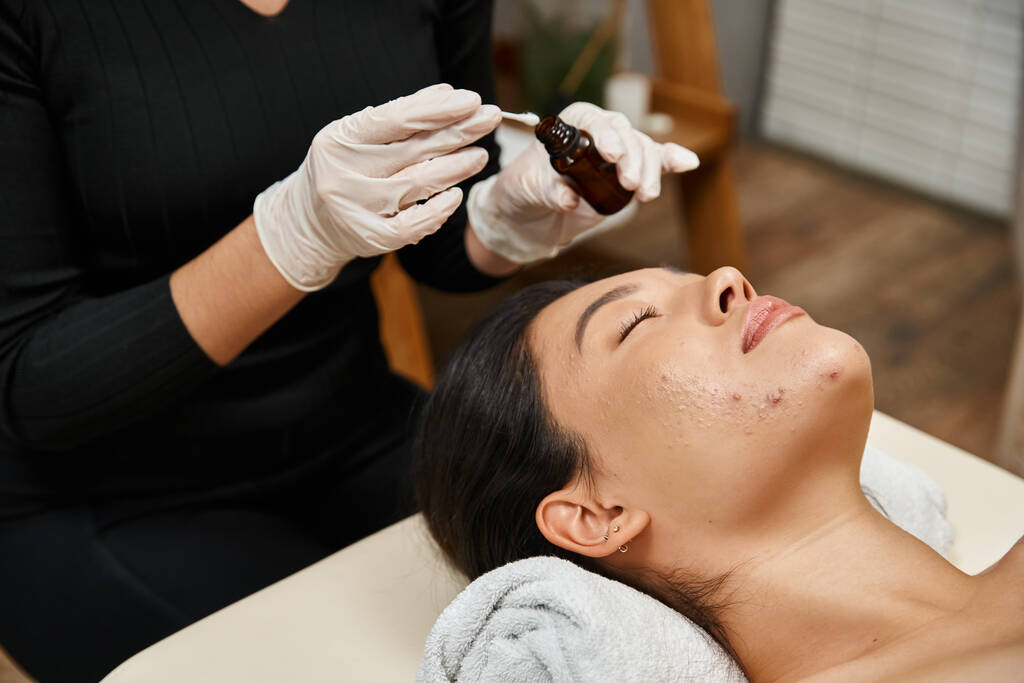 therapeut aanbrengen behandeling serum met wattenstaafje op gezicht van aziatische vrouw met acne-gevoelige huid - Foto, afbeelding