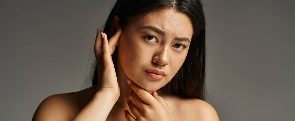 bezorgde jonge aziatische vrouw met blote schouders en acne gevoelige huid op grijze achtergrond, banner - Foto, afbeelding