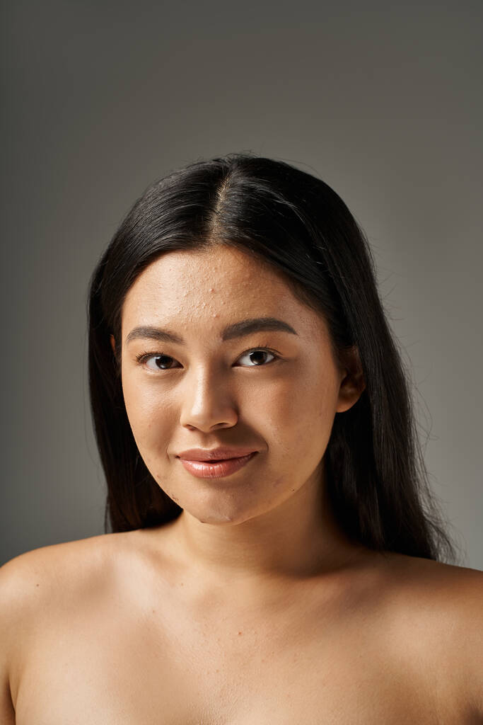 счастливая молодая азиатка с кожными проблемами и голыми плечами, смотрящая в камеру на сером фоне - Фото, изображение