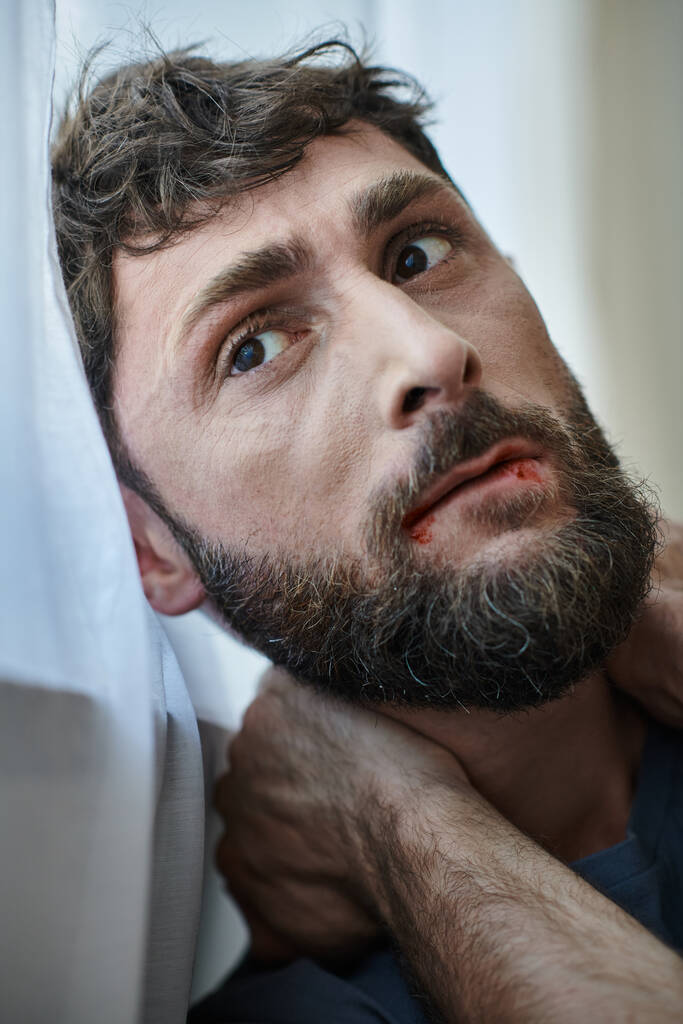 niespokojny człowiek w depresji w luźnej koszuli gryzie się w usta aż do krwi podczas załamania, zdrowie psychiczne - Zdjęcie, obraz