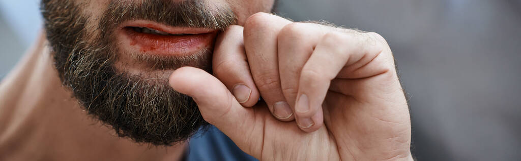 vista recortada del hombre ansioso con barba mordiéndose los labios hasta la sangre durante el episodio depresivo, pancarta - Foto, imagen
