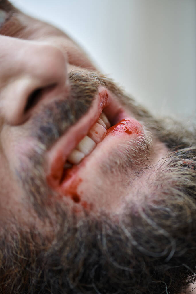 vista recortada del hombre ansioso mordiéndose los labios hasta la sangre durante el episodio depresivo, salud mental - Foto, Imagen