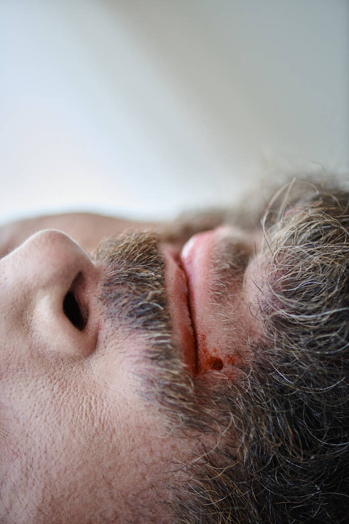 обрізаний вид тривожного чоловіка кусає губи до крові під час депресивного епізоду, психічне здоров'я - Фото, зображення