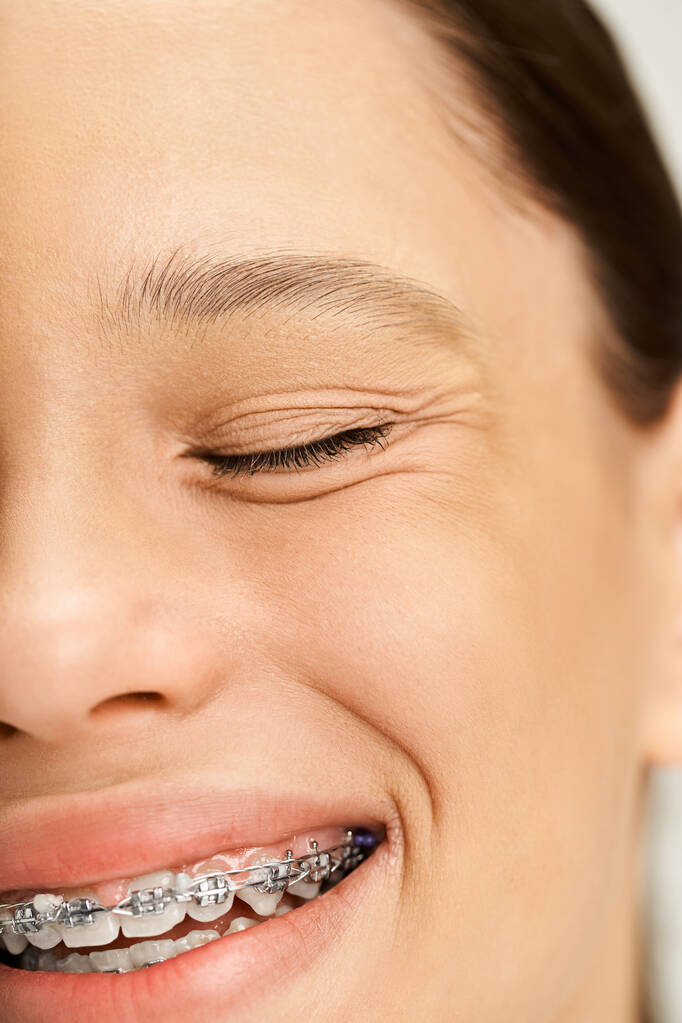 Μια κομψή έφηβη με ζωντανή ενδυμασία χαμογελά χαρούμενα, επιδεικνύοντας τα σιδεράκια της στα δόντια της.. - Φωτογραφία, εικόνα