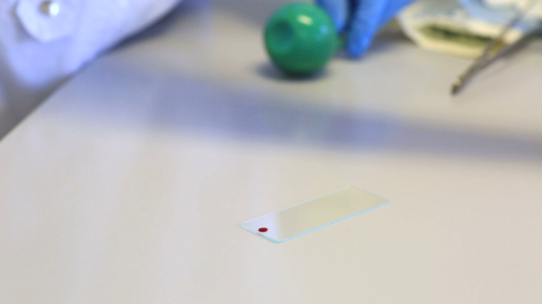 Preparation of smear. Applying drop of blood on glass slide, and the erosion of its cover glass. - Filmati, video